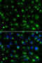 Golgi Associated, Gamma Adaptin Ear Containing, ARF Binding Protein 2 antibody, 14-174, ProSci, Immunofluorescence image 