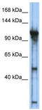 General Transcription Factor IIIC Subunit 2 antibody, TA329690, Origene, Western Blot image 