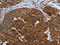 Gamma-synuclein antibody, CSB-PA580970, Cusabio, Immunohistochemistry frozen image 
