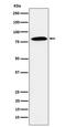 Protein DBF4 homolog A antibody, M01348, Boster Biological Technology, Western Blot image 