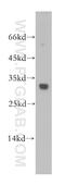 Purine Nucleoside Phosphorylase antibody, 18009-1-AP, Proteintech Group, Western Blot image 