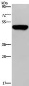 Proteasome 26S Subunit, Non-ATPase 11 antibody, PA5-50566, Invitrogen Antibodies, Western Blot image 
