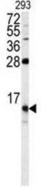 FKBP Prolyl Isomerase 1B antibody, GTX81257, GeneTex, Western Blot image 