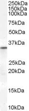 Voltage-dependent anion-selective channel protein 2 antibody, LS-C55665, Lifespan Biosciences, Western Blot image 