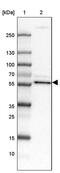 Cyclic Nucleotide Binding Domain Containing 2 antibody, PA5-60272, Invitrogen Antibodies, Western Blot image 