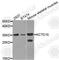 Potassium Channel Tetramerization Domain Containing 15 antibody, A8256, ABclonal Technology, Western Blot image 