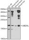 Ubiquitin Conjugating Enzyme E2 N Like (Gene/Pseudogene) antibody, GTX65599, GeneTex, Western Blot image 