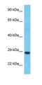 Sad1 And UNC84 Domain Containing 3 antibody, orb325921, Biorbyt, Western Blot image 