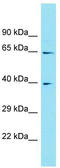 Abhydrolase Domain Containing 17C antibody, TA335493, Origene, Western Blot image 