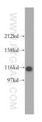 Oxoglutarate Dehydrogenase Like antibody, 17110-1-AP, Proteintech Group, Western Blot image 