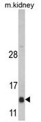 DnaJ Heat Shock Protein Family (Hsp40) Member C19 antibody, AP17286PU-N, Origene, Western Blot image 