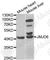 Jumonji Domain Containing 6, Arginine Demethylase And Lysine Hydroxylase antibody, A5840, ABclonal Technology, Western Blot image 