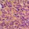 Neurofibromin 1 antibody, orb214303, Biorbyt, Immunohistochemistry paraffin image 