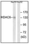 Histone Deacetylase 6 antibody, AP31170PU-N, Origene, Western Blot image 