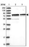Cell Division Cycle 25B antibody, NBP2-32626, Novus Biologicals, Western Blot image 