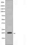 Elongation Factor Tu GTP Binding Domain Containing 2 antibody, orb226172, Biorbyt, Western Blot image 