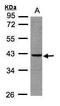 3'(2'), 5'-Bisphosphate Nucleotidase 1 antibody, GTX104970, GeneTex, Western Blot image 