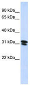 Ring Finger Protein 182 antibody, TA330519, Origene, Western Blot image 
