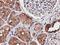 Nudix Hydrolase 6 antibody, LS-C172641, Lifespan Biosciences, Immunohistochemistry frozen image 
