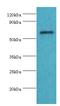Collagen Type X Alpha 1 Chain antibody, LS-C375488, Lifespan Biosciences, Western Blot image 