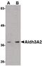 Aldehyde Dehydrogenase 3 Family Member A2 antibody, PA5-20603, Invitrogen Antibodies, Western Blot image 