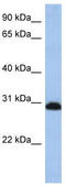 Proteasome 26S Subunit, Non-ATPase 8 antibody, TA346574, Origene, Western Blot image 
