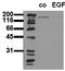 EGFR antibody, AM00044PU-N, Origene, Western Blot image 