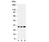 Oncostatin M antibody, R30753, NSJ Bioreagents, Western Blot image 