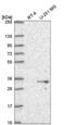 Proteasome Assembly Chaperone 1 antibody, NBP2-55971, Novus Biologicals, Western Blot image 