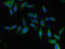 YTH N6-Methyladenosine RNA Binding Protein 2 antibody, LS-C398197, Lifespan Biosciences, Immunofluorescence image 