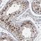Zinc Finger Protein 711 antibody, NBP1-85538, Novus Biologicals, Immunohistochemistry frozen image 