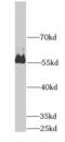 Pancreatic alpha-amylase antibody, FNab00382, FineTest, Western Blot image 