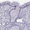 RAD52 Motif Containing 1 antibody, HPA067546, Atlas Antibodies, Immunohistochemistry paraffin image 