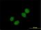 CKB antibody, H00001120-B01P, Novus Biologicals, Immunofluorescence image 