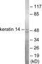 Keratin 14 antibody, EKC1610, Boster Biological Technology, Western Blot image 