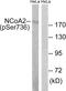 Nuclear receptor coactivator 2 antibody, P01706, Boster Biological Technology, Western Blot image 