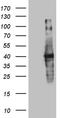 Uracil Phosphoribosyltransferase Homolog antibody, TA809847, Origene, Western Blot image 