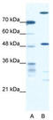 Cysteine desulfurase, mitochondrial antibody, TA331805, Origene, Western Blot image 