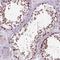 O-6-Methylguanine-DNA Methyltransferase antibody, HPA069497, Atlas Antibodies, Immunohistochemistry frozen image 