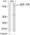 Insulin Like Growth Factor 1 Receptor antibody, AP02620PU-N, Origene, Western Blot image 