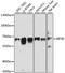 Eukaryotic translation initiation factor 3 subunit D antibody, GTX64820, GeneTex, Western Blot image 