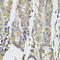 Parathyroid Hormone Like Hormone antibody, 14-459, ProSci, Immunohistochemistry paraffin image 