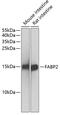 Fatty Acid Binding Protein 2 antibody, 16-492, ProSci, Western Blot image 