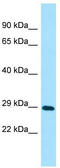 Testis Expressed 35 antibody, TA331698, Origene, Western Blot image 