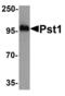 5'-Nucleotidase, Cytosolic IIIB antibody, LS-C153667, Lifespan Biosciences, Western Blot image 