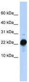 Chorionic Somatomammotropin Hormone Like 1 antibody, TA346286, Origene, Western Blot image 