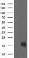 NME/NM23 Nucleoside Diphosphate Kinase 2 antibody, NBP2-45859, Novus Biologicals, Western Blot image 