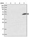 PiggyBac Transposable Element Derived 4 antibody, NBP1-81995, Novus Biologicals, Western Blot image 