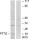 PTTG1 Interacting Protein antibody, LS-B6285, Lifespan Biosciences, Western Blot image 