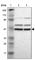 Proteasome 26S Subunit, ATPase 4 antibody, HPA005471, Atlas Antibodies, Western Blot image 